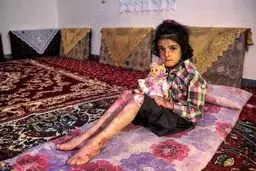 سایه تحریم دارویی آمریکا بر جان کودکان ایرانی