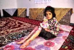 سایه تحریم دارویی آمریکا بر جان کودکان ایرانی