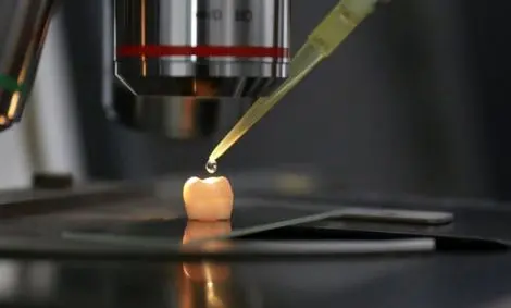 بازسازی دندان‌ها با استفاده از سلولهای بنیادی ممکن می‌شود