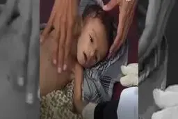 سازمان ملل: هر ۱۲ دقیقه، یک کودک زیر ۵ سال در یمن جان می‌بازد