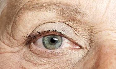 خوراکی‌هایی که برای پوست شما بهتر از بوتاکس عمل می‌کنند