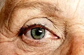 خوراکی‌هایی که برای پوست شما بهتر از بوتاکس عمل می‌کنند