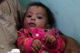 این دختر ۹ ماهه اشک کاربران مجازی را درآورد + عکس