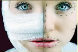 آشفته بازار زیبایی/ وقتی عطش شهرت و دیده‌شدن به خلق چهره‌های ترسناک ختم می‌شود!