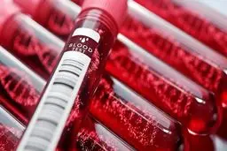 علت مسمومیت ۵۱ کودک داورزنی در دست بررسی است