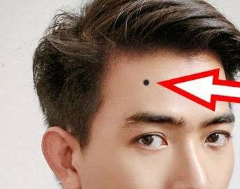 از روی خال‌ها در نقاط گوناگون بدن شخصیت خود را بشناسید