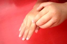 عارضه‌ای پوستی که دانش‌آموزان را درگیر می‌کند