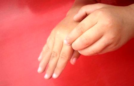 عارضه‌ای پوستی که دانش‌آموزان را درگیر می‌کند