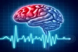 مردم علائم سکته مغزی را جدی بگیرند