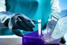 آغاز صادرات محصولات دانش‌بنیان سلول‌های بنیادی از سال جاری