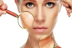 پوستت سرما نخورد!