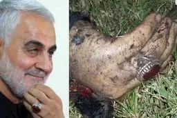 راز سالم ماندن دست و انگشتر سردار سلیمانی