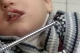 بازیگوشی پسربچه مرندی با میله آهنی حادثه ساز شد