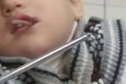 بازیگوشی پسربچه مرندی با میله آهنی حادثه ساز شد