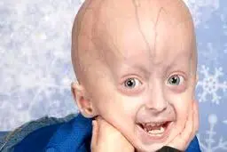 تخمین ۳میلیون «بیمار نادر» در ایران / هشدارِ ازدواج فامیلی و سن بالای بارداری